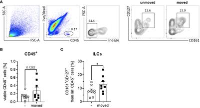 Exploring the role of innate lymphoid cells in the periodontium: insights into immunological dynamics during orthodontic tooth movement